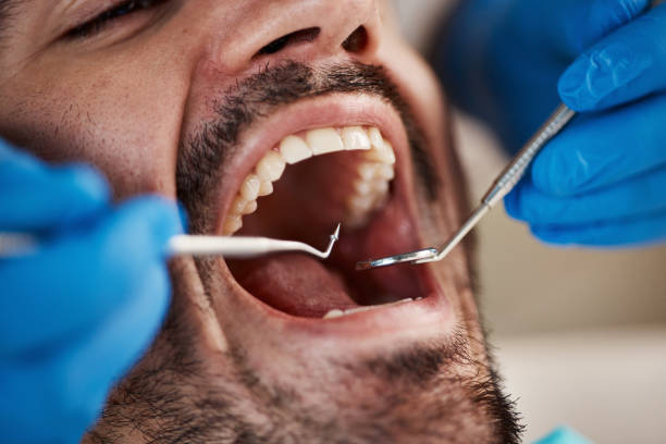 Best Teeth Whitening  in Fort Polk North, LA